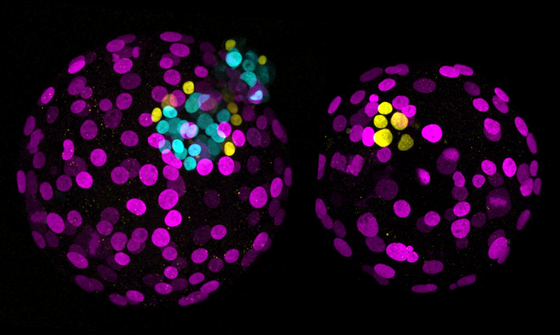 Day 6 human embryos showing the effect of NANOG presence versus absence, provided compliments of Katarina Harasimov, Oliver Bower and Kathy Niakan, Loke Centre for Trophoblast Research, University of Cambridge.