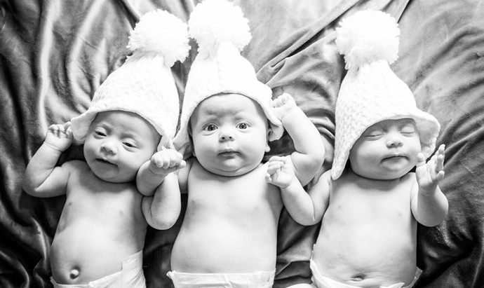 successful IVF with endometriosis