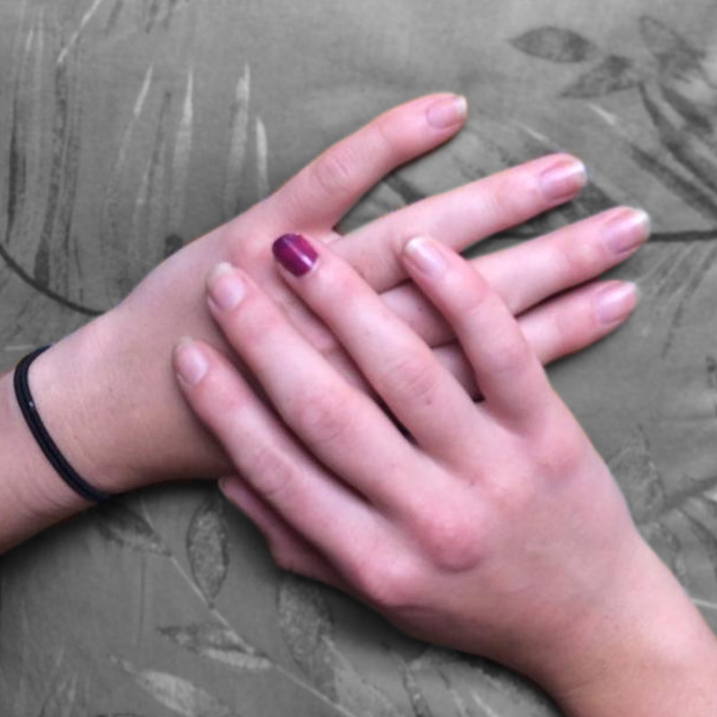 PCOS and infertility - painting a nail to raise awareness PCOS and infertility - painting a nail to raise awareness