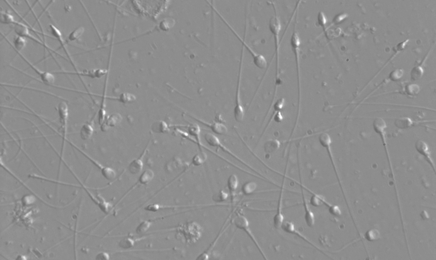 IMSI allows sperm to be viewed at high magnification