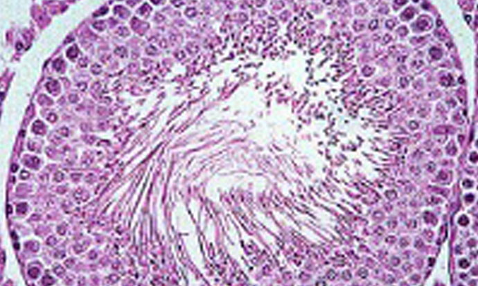 Section-of-Seminiferous-Tubules